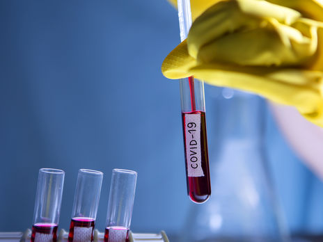 Минздрав Украины ввел единый протокол лечения COVID-19