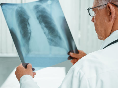 В Украине будут тестировать на коронавирус всех больных с вирусными пневмониями