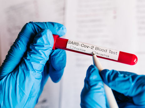 В Луцке двое медработников заразились во время вскрытия тела гинеколога, болевшего COVID-19