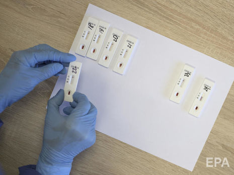 Число жертв коронавируса в Украине выросло до 37