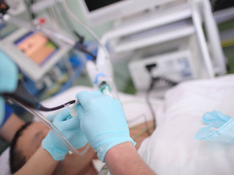 К аппаратам ИВЛ в Украине подключены 38 больных COVID-19