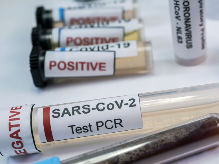 В Украине тестирование на коронавирус провели 11 136 жителям – Минздрав