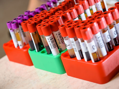 ﻿Під час виходу з карантину українців планують тестувати на антитіла до коронавірусу – Ляшко