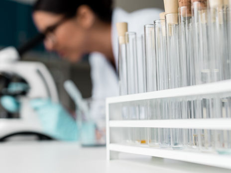 В Украине есть около 200 тыс. ПЦР-тестов на коронавирус – Минздрав