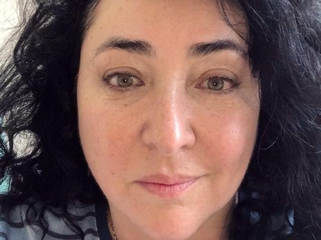 ﻿Лоліта: Я двічі робила пластичні операції. Ближче до літа ще раз піду