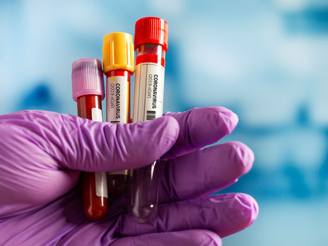 ﻿МОЗ України очікує зростання нових випадків інфікування коронавірусом за 5–10 днів після Великодня