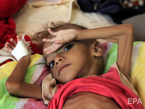 Коронавирус может вдвое увеличить количество людей, страдающих от голода — ООН