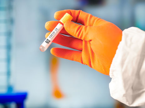 Протягом доби коронавірус підтвердили ще у 477 українців, загальна кількість інфікованих збільшилася до 7647