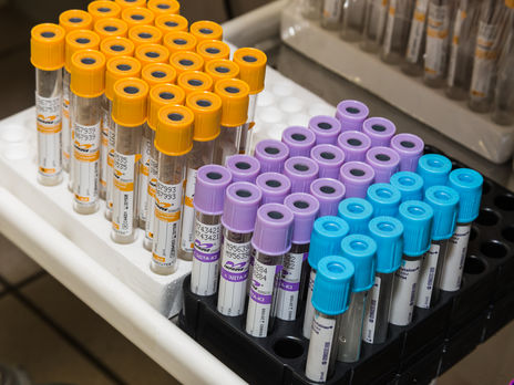 В Тернополе с COVID-19 госпитализирован священник УПЦ МП