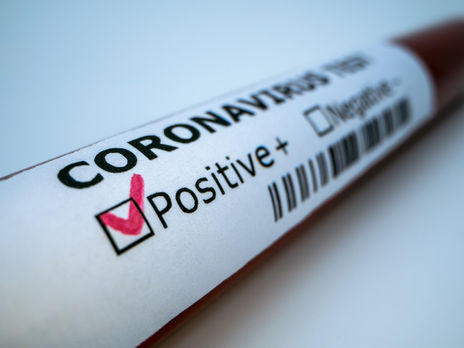 ﻿Протягом доби в Україні виявлено 478 нових випадків COVID-19