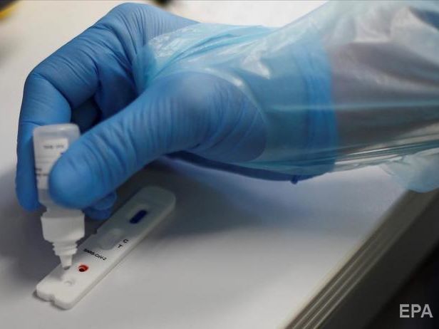 ﻿Кількість тестів на коронавірус методом ПЛР збільшать до 8–10 тис. на добу