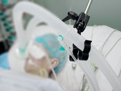 Правительство выделило 100 млн грн на закупку аппаратов ИВЛ