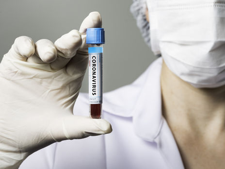 ﻿Разумков вважає, що на COVID-19 може хворіти до 15 нардепів