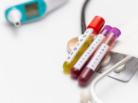 За сутки в Украине коронавирус подтвердили еще у 418 человек, 15 больных скончались 