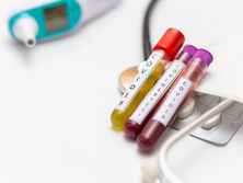 За сутки в Украине коронавирус подтвердили еще у 418 человек, 15 больных скончались 