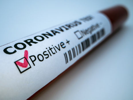 Лаборатория в Танзании якобы выявила коронавирус в папайе. Руководство учреждения отстранили от работы