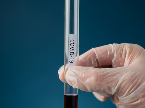 На Закарпатье случилась вспышка COVID-19 в школе-интернате