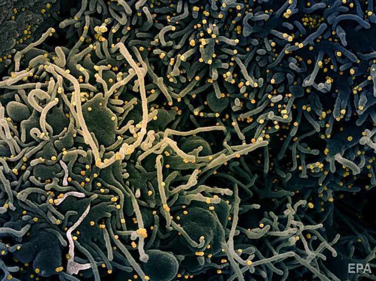 Учені виявили коронавірус у спермі інфікованих чоловіків. Можливо, COVID-19 передається статевим шляхом