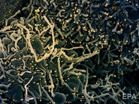 Учені виявили коронавірус у спермі інфікованих чоловіків. Можливо, COVID-19 передається статевим шляхом