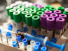 За сутки коронавирус в Украине подтвердили еще у 416 человек, 17 умерли