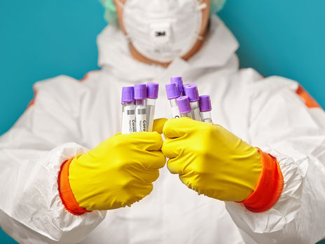 Число новых заражений коронавирусом в Украине уменьшается: за сутки зафиксировали 375 случаев 