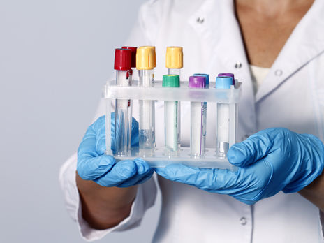 В Украине впервые провели более 8 тыс. тестирований на коронавирус за сутки