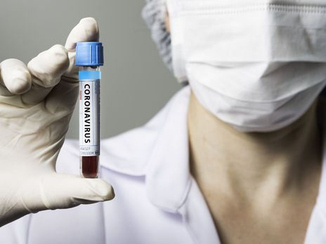 За сутки в Украине коронавирус подтвердили еще у 483 человек, 20 больных умерли 