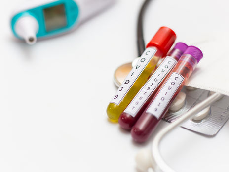 В Украине – 260 новых инфицированных коронавирусом. Это самый низкий показатель с начала апреля 