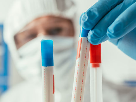 ﻿Кількість нових випадків інфікування коронавірусом в Україні знову збільшилася, за добу померло 11 осіб 