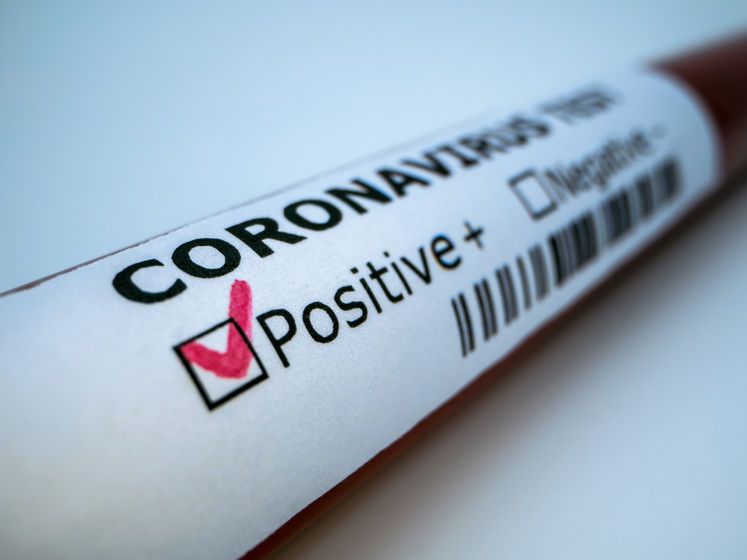 ﻿Протягом доби коронавірус в Україні виявили у 429 осіб
