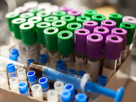 Количество инфицированных коронавирусом в Украине превысило 24 тыс., число новых случаев снизилось