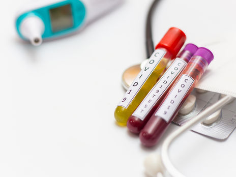 Число новых случаев коронавируса в Украине снижается пятый день подряд, за сутки умерло 13 человек