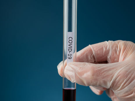 В Беларуси количество больных COVID-19 превысило 50 тыс.