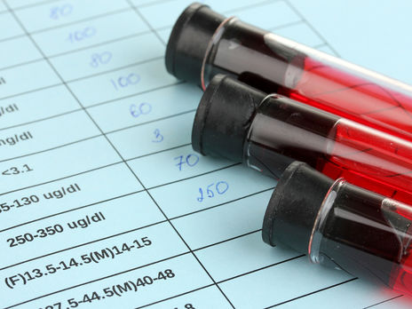 В РФ за последние сутки выявили 8706 случаев инфицирования COVID-19