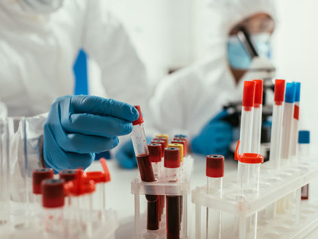 ﻿10 областей України не відповідають умовам другого етапу послаблення карантину – МОЗ