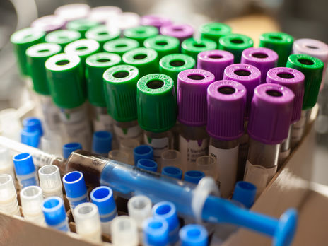 Коронавирус в Украине. Шестые сутки число новых случаев превышает 600 