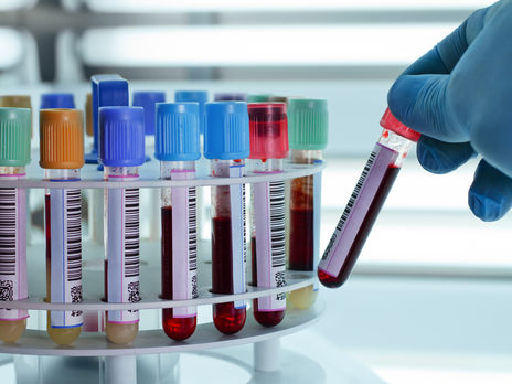 ﻿В Україні другий день поспіль фіксують зниження кількості нових випадків COVID-19