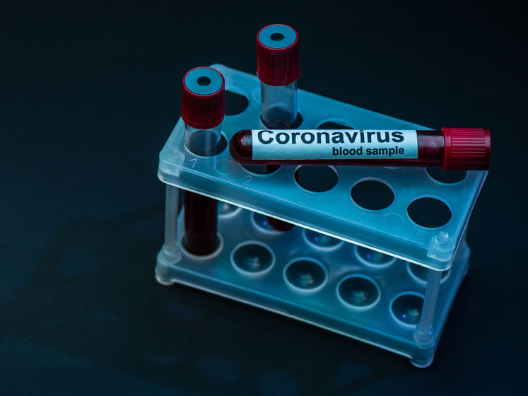 ﻿Кількість нових випадків коронавірусу в Україні суттєво знизилася – до мінімуму з 9 червня