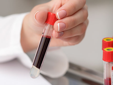 10 областей не соответствуют условиям ослабления карантина – Минздрав Украины