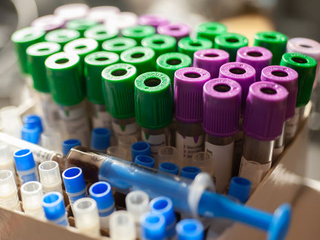 В Украине зафиксирован один из самых высоких показателей смертности от коронавируса за сутки с начала эпидемии