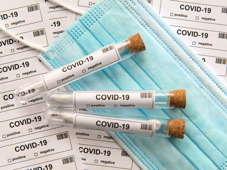 За последние сутки в Украине на коронавирус протестировали в два раза меньше человек, чем в будни