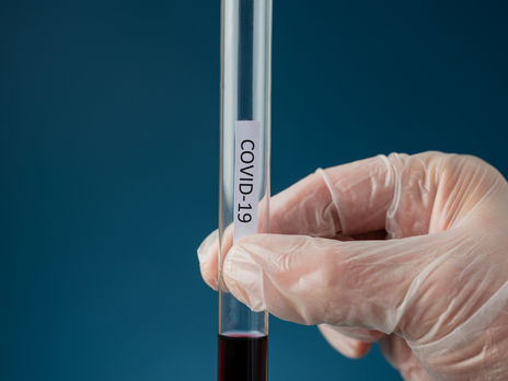 Минздрав Украины расширил список стран 