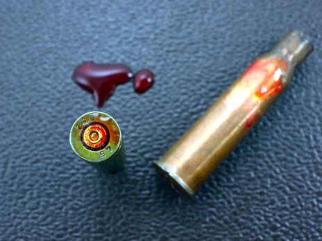 В Николаеве госпитализировали активиста с огнестрельным ранением в голову