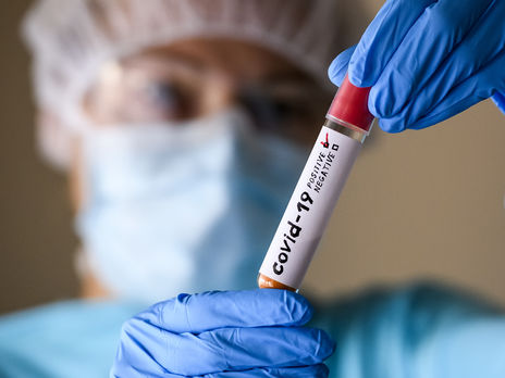За сутки в Украине сделали 9711 тестирований на коронавирус методом ПЦР