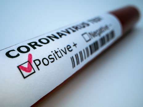 В Киеве еще у 112 человек подтвердили COVID-19