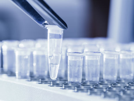 ﻿У харківському аеропорту можна буде зробити ПЛР-тест на COVID-19