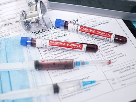 Каждая третья область Украины не отвечает условиям ослабления карантина – Минздрав