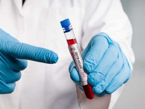 10 областей Украины не соответствуют условиям ослабления карантина – Минздрав