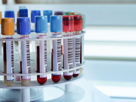 Половина областей Украины не соответствуют условиям ослабления карантина – Минздрав