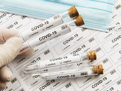 Ущерб на 2 млн грн. Херсонский лабораторный центр закупил некачественные тесты для диагностики COVID-19 – СБУ